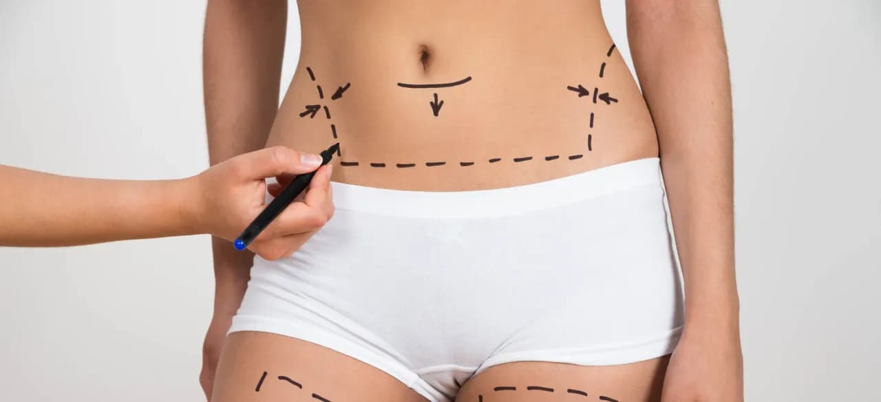 Czy liposukcja kawitacyjna jest skuteczna? Poznaj prawdę o efektach